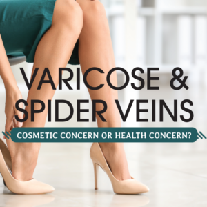 Varicose and Spider Veins: Cosmetic Concern or Health Concern?